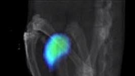 Nanorobot si muovono nell'organismo di topi vivi 