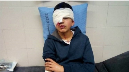 パレスチナ人青年が、イスラエル兵の銃撃で片目失明