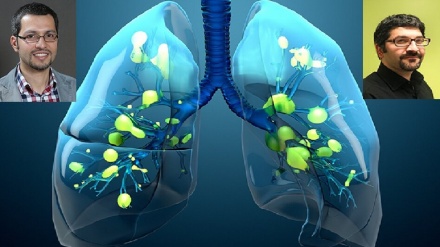 伊朗研究人员成功发现难以治疗COVID-19新型冠状病毒患者的原因