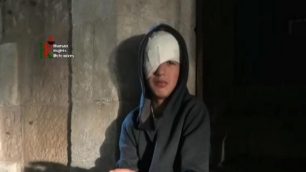 Tredicenne perde l'occhio durante sparatoria sionista + VIDEO