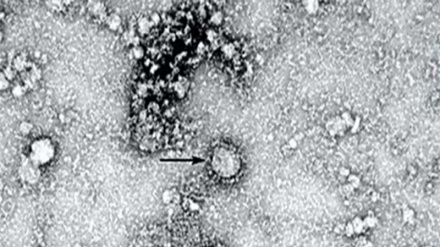 Филми микроскопӣ аз лаҳзаи олуда шудани ҳуҷайраи солим ба вируси корона