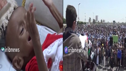 सनआ में यमनी बच्चों का प्रदर्शन, हर रोज़ 300 बच्चों की कुपोषण से हो रही है मौत, सऊदी और अमरीकी अपराध पर यूएन ख़ामोश