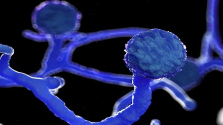 এবার চট্টগ্রামে করোনা রোগীর দেহে ব্লাক ফাঙ্গাস শনাক্ত 