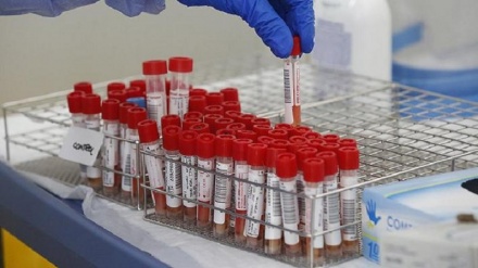 ثبت 73 مورد جدید کووید 19 در تاجیکستان