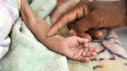 ユニセフ、「10分毎にイエメン人の子ども1人が死亡」