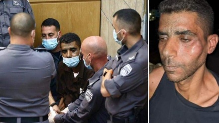 Zakaria, evaso palestinese, in rianimazione per torture subite