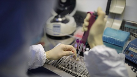 Հայաստանում հաստատվել է կորոնավիրուսով վարակվելու 587 նոր դեպք. Մահացել է 16 քաղաքացի