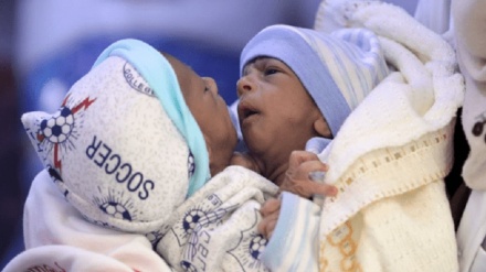 也门的一对连体双胞胎成为沙特联军围攻的最新受害者