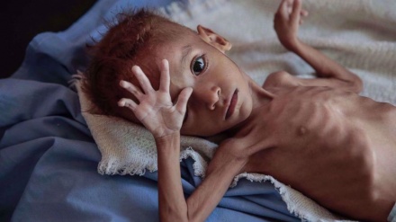 Protracted war in Yemen has killed or maimed 10,000 children: UNICEF