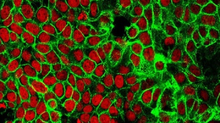 Ecco perché la dieta povera di grassi affama i tumori