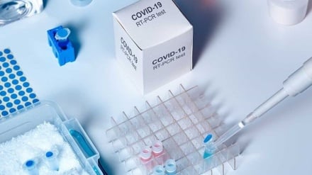 Հայաստանում հաստատվել է կորոնավիրուսի 1675 նոր դեպք, առողջացել է 1277 մարդ