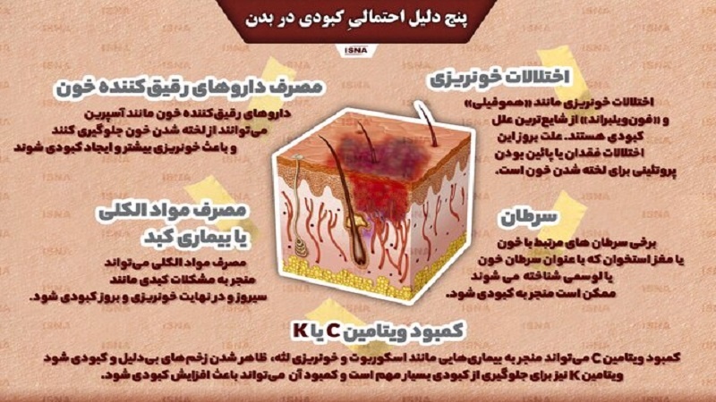 Панҷ далили эҳтимоли кабудӣ дар бадан