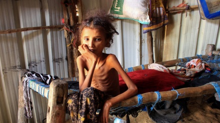 Ibu dan Bayi Yaman Menghadapi 'Horor yang Tak Terbayangkan'