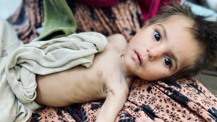 Vdekja e heshtur dhe pa bombardime e fëmijëve në Afganistan