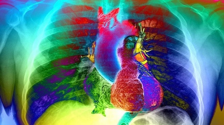 Heart-disease risk soars after COVID — even with a mild case