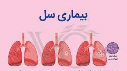 Назари теъдоде аз шаҳрвандони тоҷик дар бораи роҳҳои сирояту дармони бемории сил