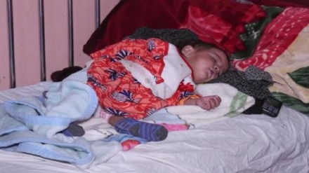 هشدار پزشکان بدون مرز درباره شیوع سرخکان در افغانستان