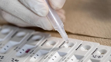 Covid Italia: 99.848 nuovi positivi, 205 le vittime