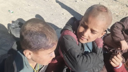 ابتلای صدها کودک در ولایت زابل به یک بیماری ویروسی