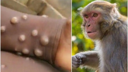 巴勒斯坦被占地区发现首例猴痘确诊病例
