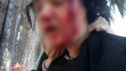 Türk polisi Afgan mültecileri tartakladı 