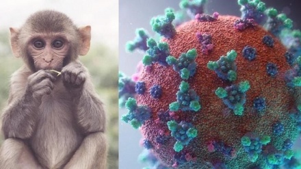 تب و بدن درد از علائم اولیه بیماری «آبله میمون»