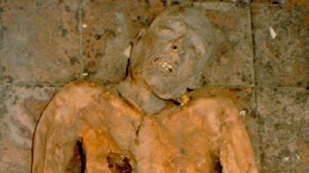 Diagnosi su una mummia, scoperta un'infezione dopo 5 secoli