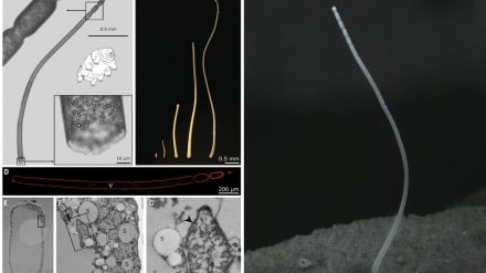 Un batterio lungo 1 centimetro sfida le leggi della biologia 