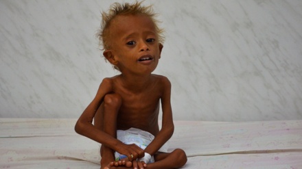 8 年的战争造成3100 多名也门儿童丧生