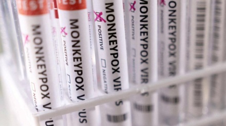 法国猴痘确诊病例增至51起