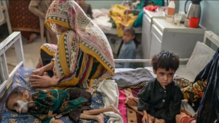 یونیسف: بیش از 3 میلیون کودک افغان با خطر سوء تغذیه مواجه هستند