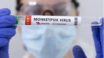 אובחן מקרה הדבקה ראשון באבעבועות הקוף בקובה  ובאינדונזיה