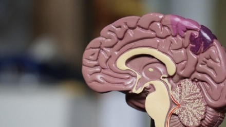 Il morbo di Alzheimer non è uguale in uomini e donne