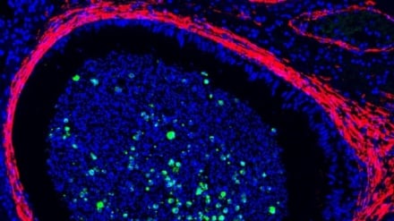 Il virus del vaiolo delle scimmie potrebbe annidarsi nei testicoli