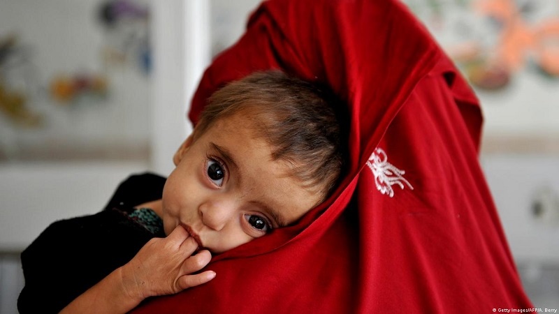 فقرو تنگدستی؛ عامل افزایش کودکان مبتلا به سوء تغذیه در افغانستان