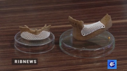 Иранской компании удалось напечатать роговицу глаза с помощью стволовых клеток и 3D-биопринтера