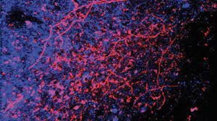 Scoperto il percorso delle carezze, dalla pelle al cervello