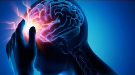 مغز چگونه سکته می‌کند؟