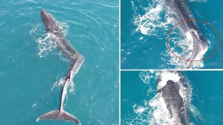 Умуртқа поғонаси  эгри кит!(видео)