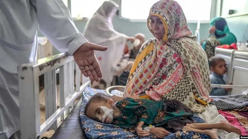 افزایش شمار کودکان مبتلا به سوءتغذیه در افغانستان