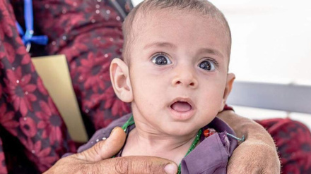 په تیرو پنځو میاشتو کې د ۲۷۰ زره خوارځواکۍ ماشومانو درملنه شوی ده