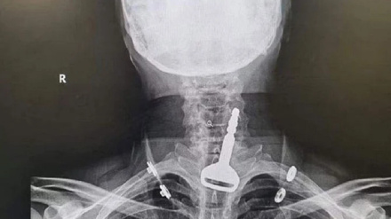 د سعودي عربستان ښاریز د ګاډي چابۍ تیرې کړې