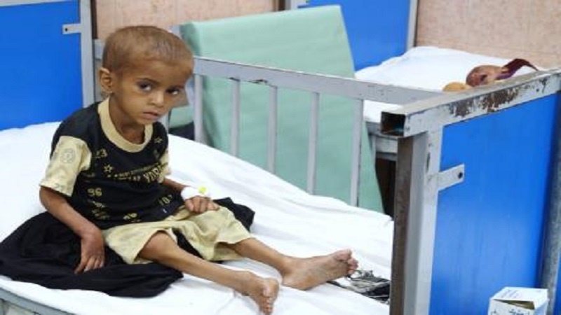 یونیسف: 270 هزار کودک مبتلا به سوءتغذیه در افغانستان درمان شدند