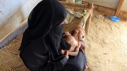 ВПП ООН приостановит программу профилактики недоедания в Йемене из-за нехватки средств
