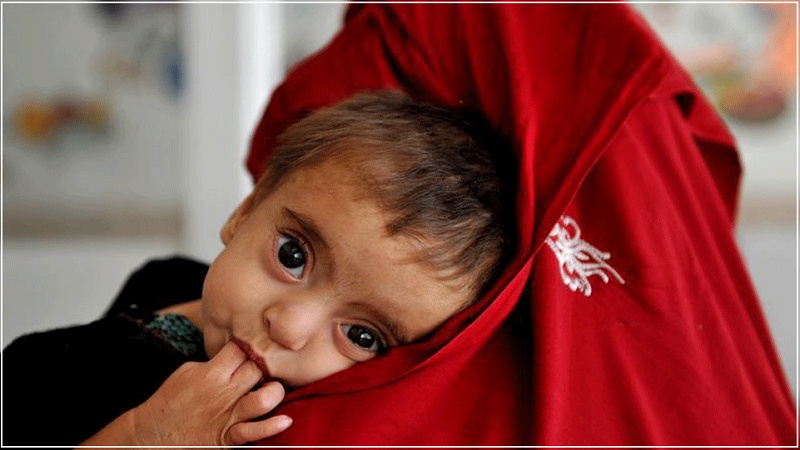 کمک یونیسف به صدها هزار کودک مبتلا به سوءتغذیه در افغانستان