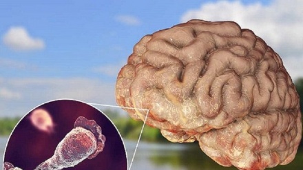 Ameba mangia cervello: Cos’e’, sintomi, dove vive