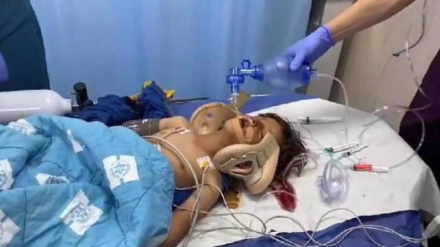 (AUDIO) Bambino palestinese investito da un colono israeliano: e' grave
