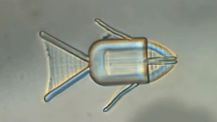 Evoluzione nel trattamento del cancro al cervello con un dispositivo piccolissimo