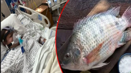 د کب خوړل د ښځې د لاسونو او د پښو د غوڅیدا سبب شول