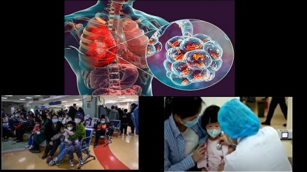  ذات الریه مشکوک در چین و پذیرش 7000 بیمار در یک روز 